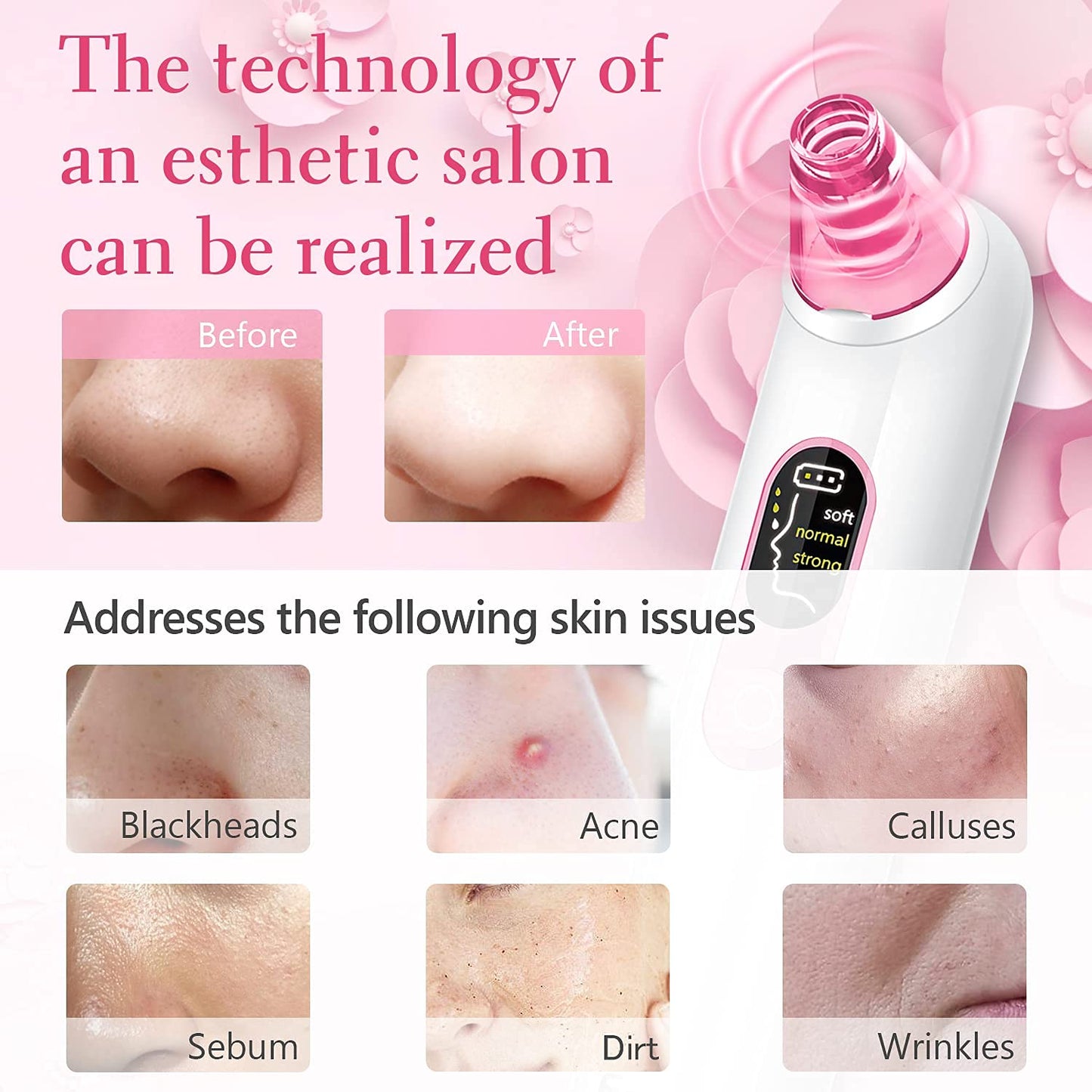 Blackhead Pore Vacuum Cleaner Remover USB Rechargeable with LCD Screen Kit Suction A21888