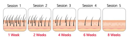 At Home Laser Hair Removal Permanent Hair Removal Device
