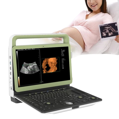 Smart Portable Ultrasound Machine MNSLCU78 | Diagnostic Ultrasound System for Hospitals