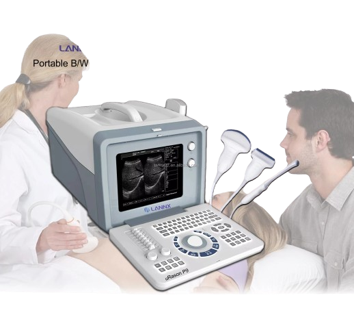 Portable ultrasound scanner for human being I laptop black/white ultrasound Machine