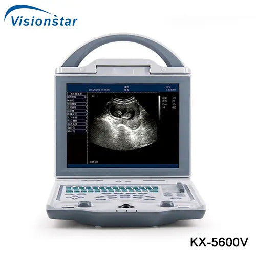 B Mode Portable Laptop Veterinary Ultrasound Scanner For Cats Dogs I KX-5600V