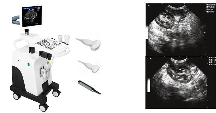 Black & White Trolley Type Veterinary Ultrasound Machine I VET-4