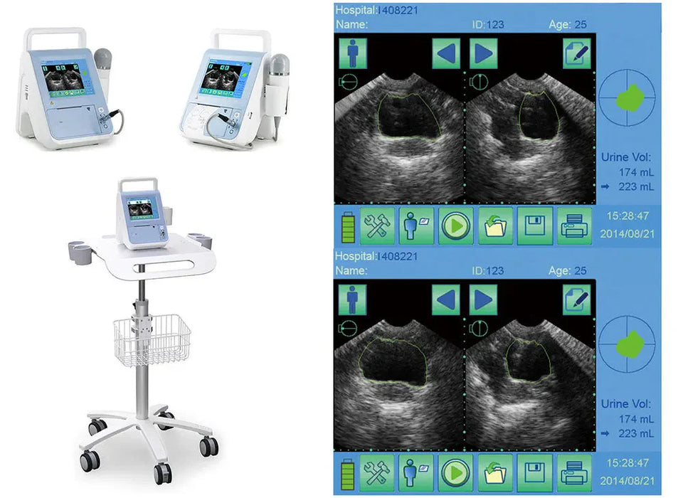 Bladder Volume Tester I BVT01 - bladder scan