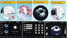 Bladder Volume Tester I Bladder Scan I MD-6000 - bladder