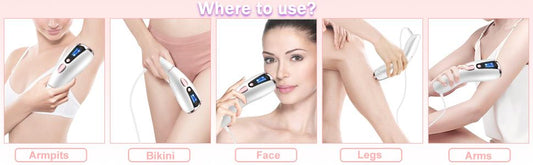 At-Home Hair Removal for Women & Men, Upgraded to 999,999 Flashes Laser Hair Removal, Permanent Painless Hair Removal Device for Facial Whole Body