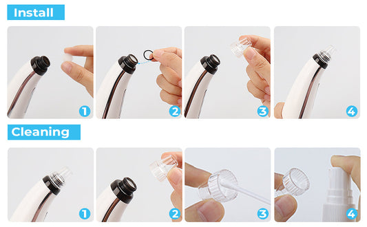 Blackhead Remover Pore Vacuum Upgraded Facial Cleaner Electric Acne Comedone Whitehead Extractor Tool-5 Suction Power 5 Probes Kit