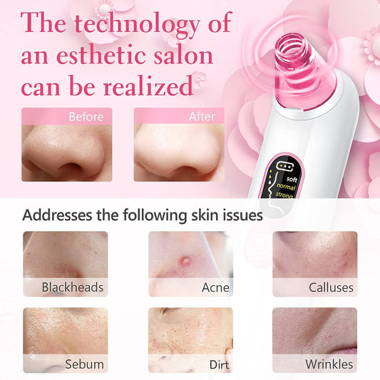 Blackhead Pore Vacuum Cleaner Remover USB Rechargeable with LCD Screen Kit Suction A21888