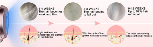 At-Home Hair Removal for Women & Men, Upgraded to 999,999 Flashes Laser Hair Removal, Permanent Painless Hair Removal Device for Facial Whole Body