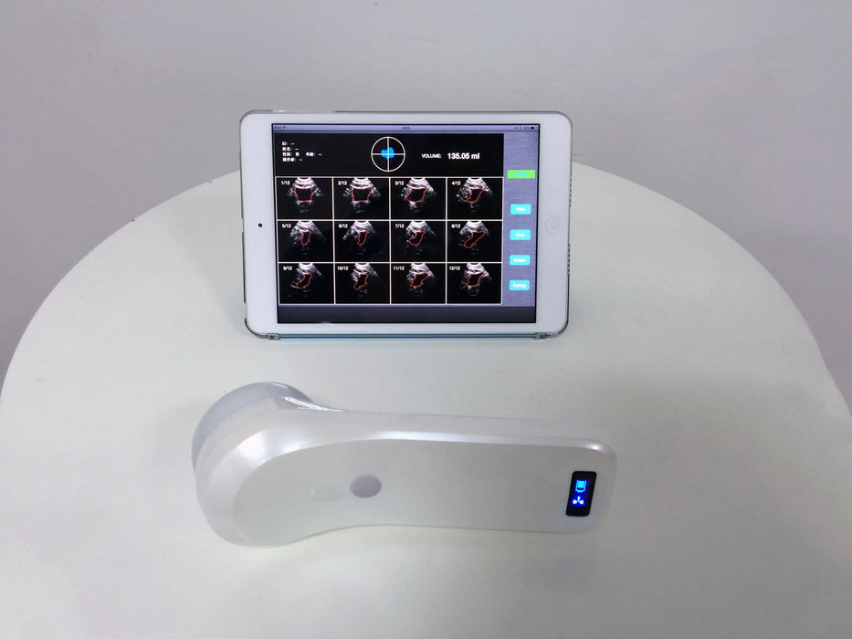 4D Wireless Bladder Scanner Bladder ultrasound