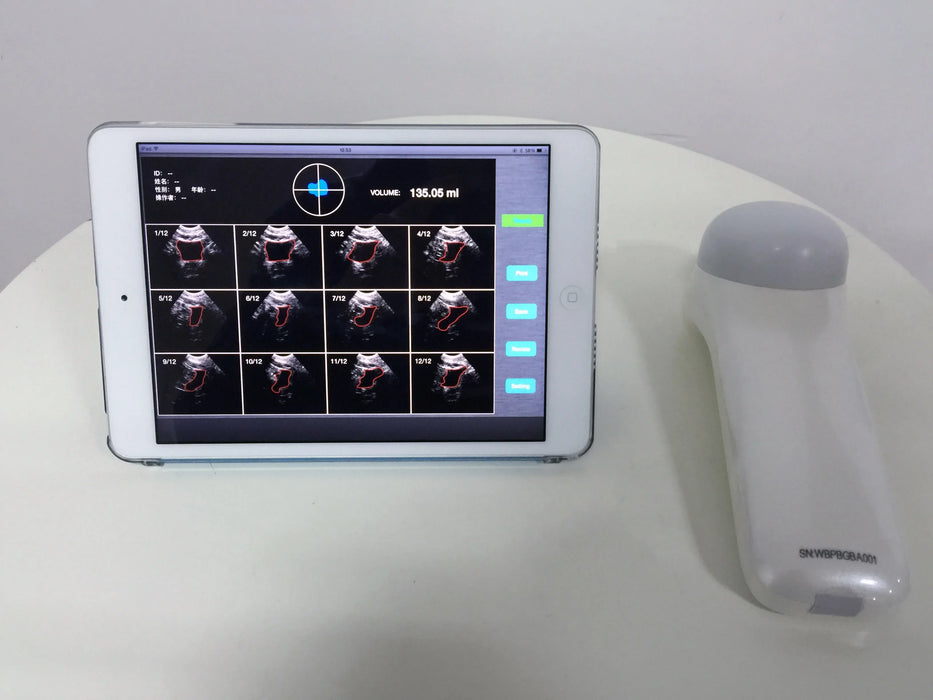 4D Wireless Bladder Scanner Bladder ultrasound