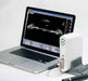 Opthalmic Ultrasound AB Scanner I Model MSW2100